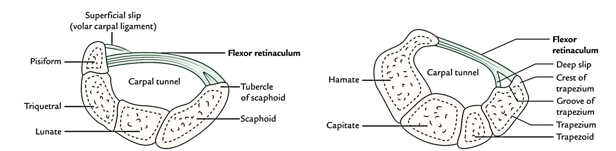 Carpal Tunnel