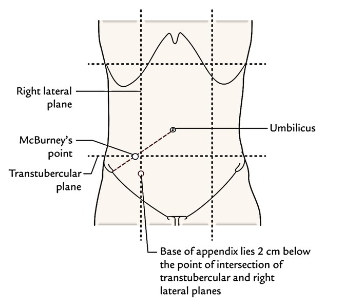 Schematic Diagram Of Mcburney S Pointer Schematic Diagram Of Mcburney S Pointer