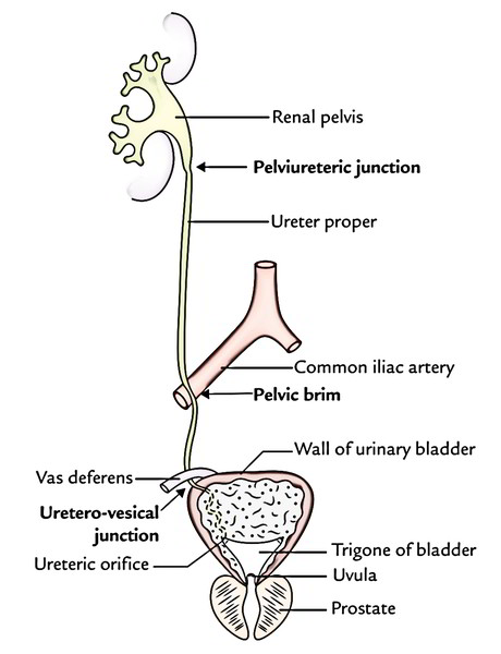 Ureter: Site of Anatomical Narrowings