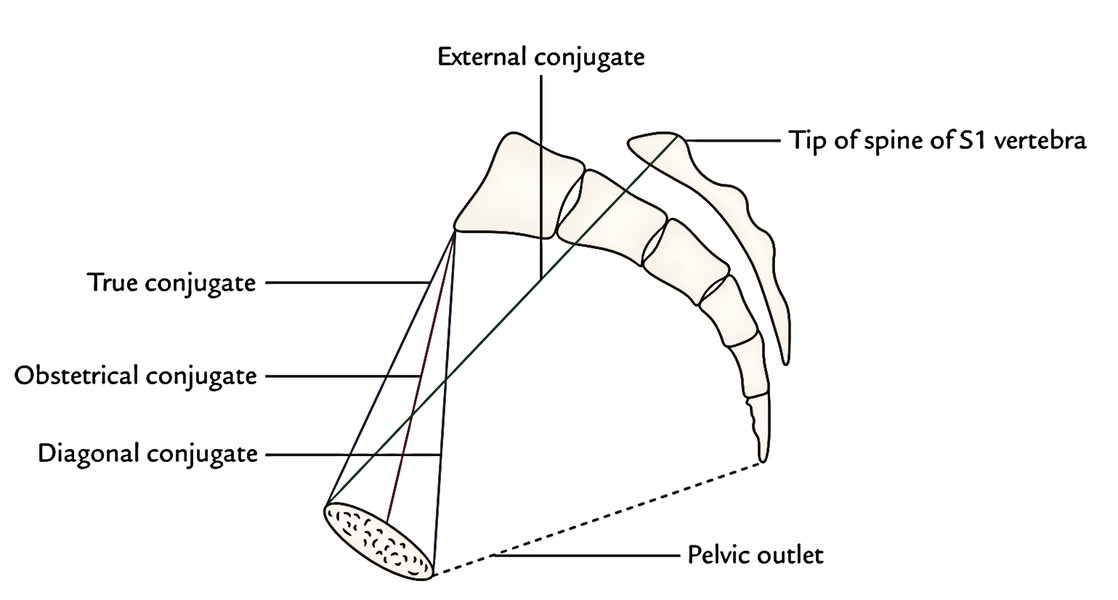 Easy Notes On  U3010obstetric Pelvis  True Pelvis  U3011learn In