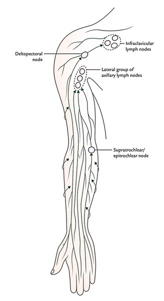 Which Area Of The Arm Drains To The Epitrochlear Nodes Best Drain