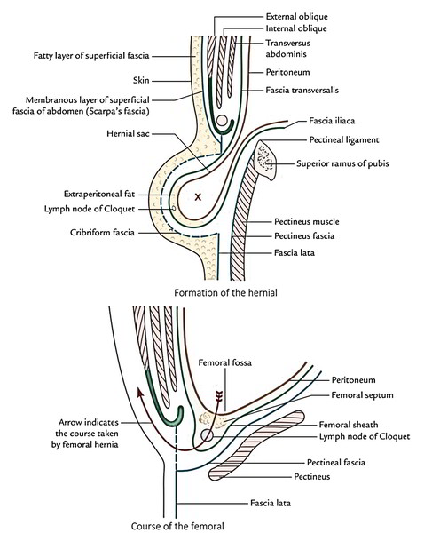 Easy Notes On 【Femoral Canal】Learn in Just 4 Minutes! – Earth's Lab