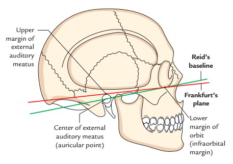 Anatomical Position of Skull