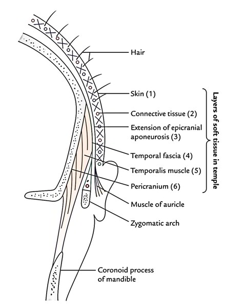 Temple: Layers of Soft Tissue