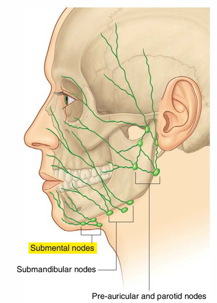 Can Wisdom Teeth Cause Swollen Lymph Nodes Neck Teethwalls