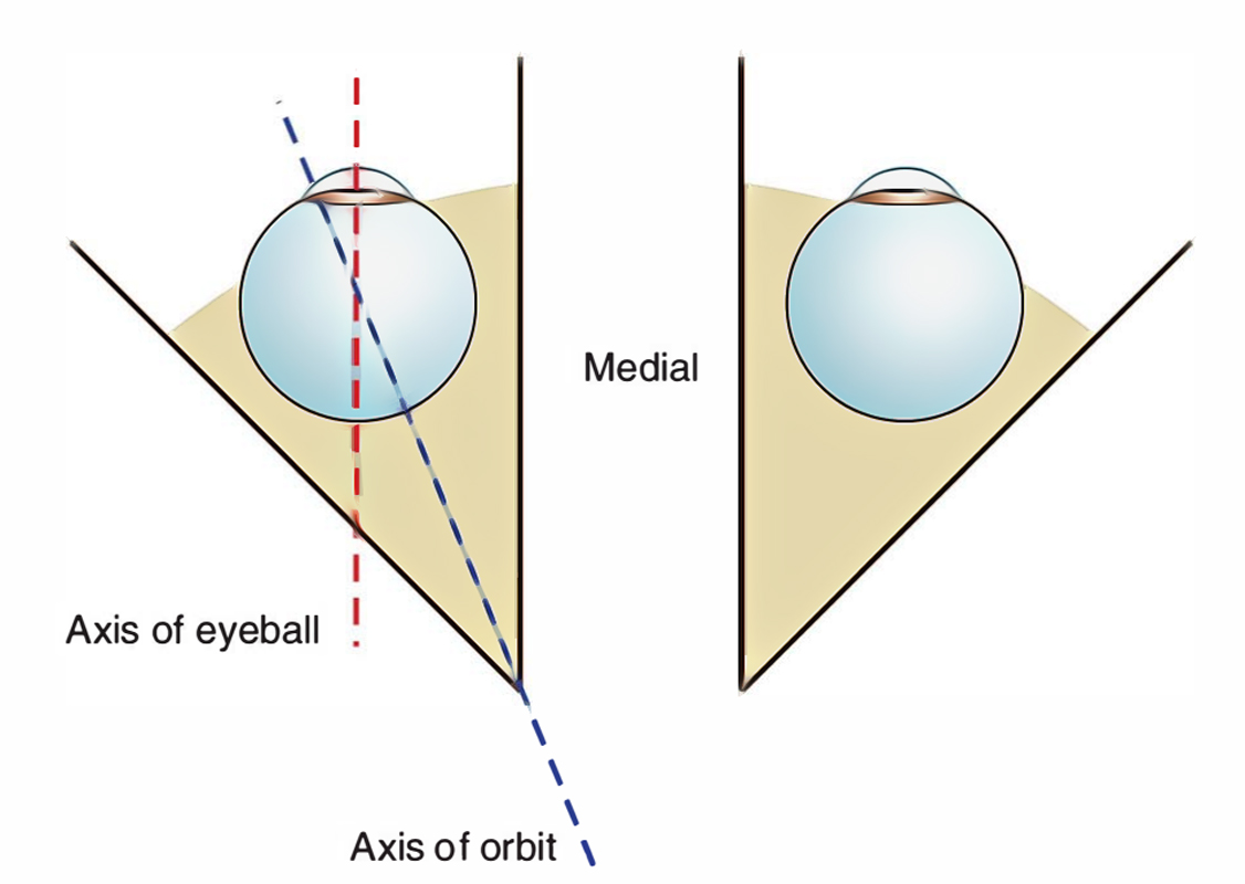 Extraocular Muscles: Axis of Movements