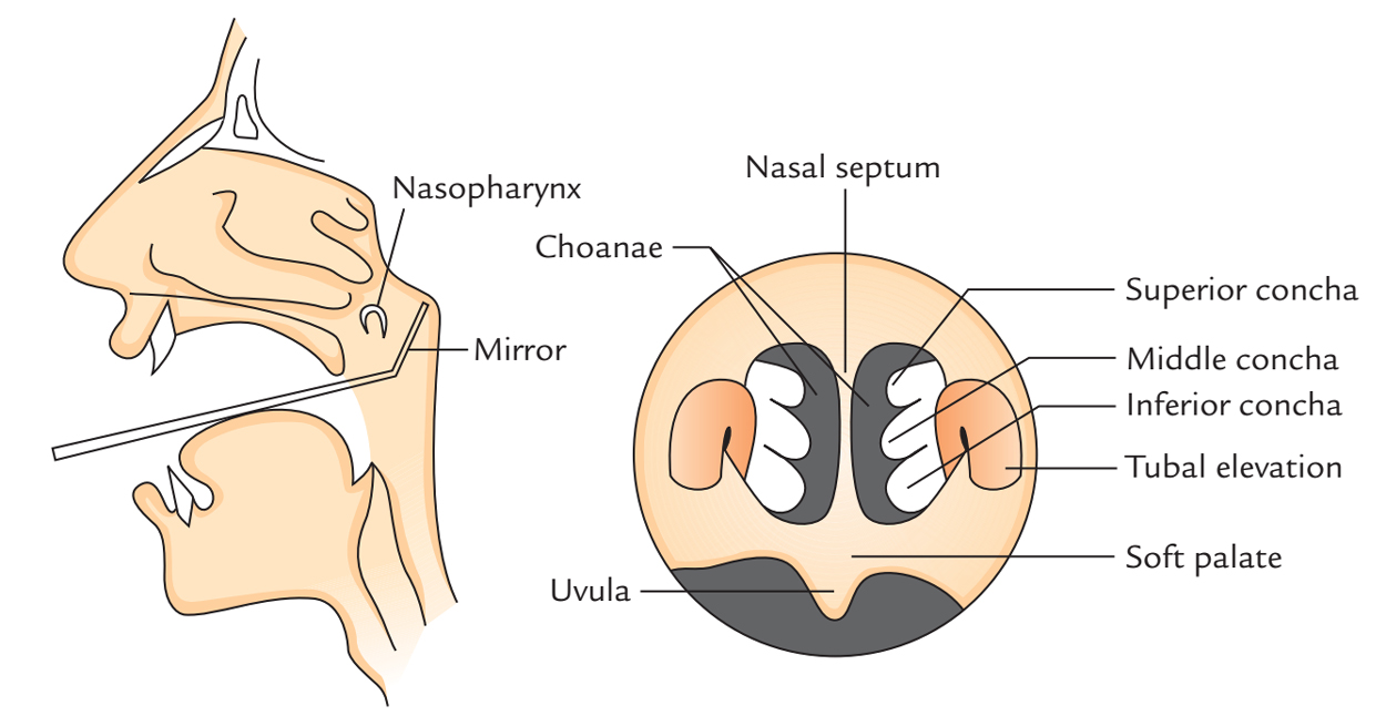 Nasal Cavity: Rhinoscopy