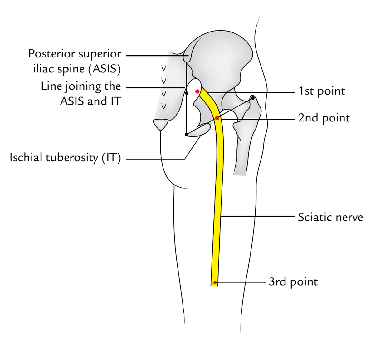 Sciatic Nerve: Surface Marking