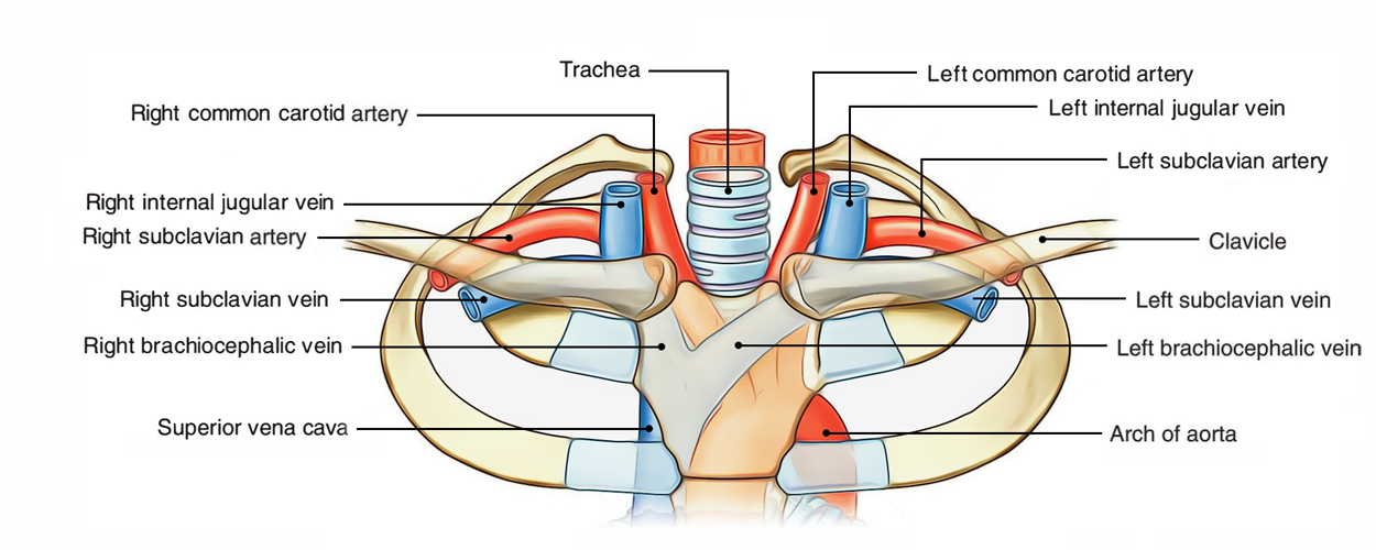 Subclavian Arteries