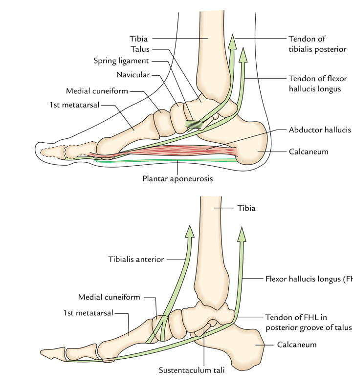 Arches of Foot: Variables Keeping the Medial Longitudinal Arch