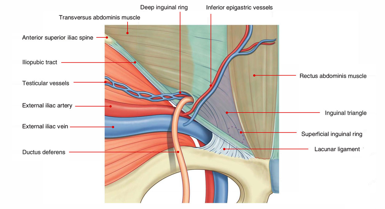 Inguinal (Hesselbach's) Triangle - Borders - Direct Hernia - TeachMeAnatomy