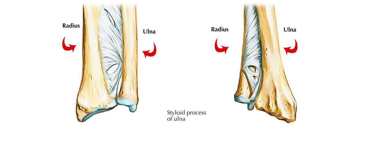 Ulna - Lower End