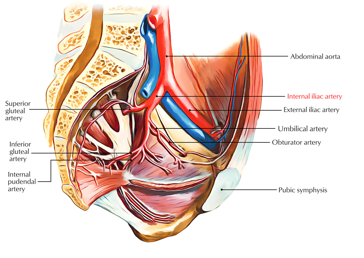 Internal Iliac Artery