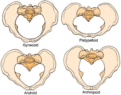 Anthropoid Pelvis