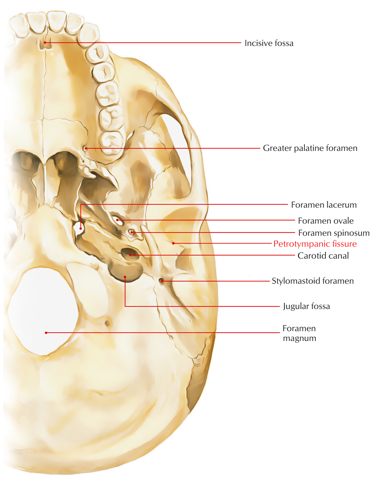 Petrotypanic Fissure