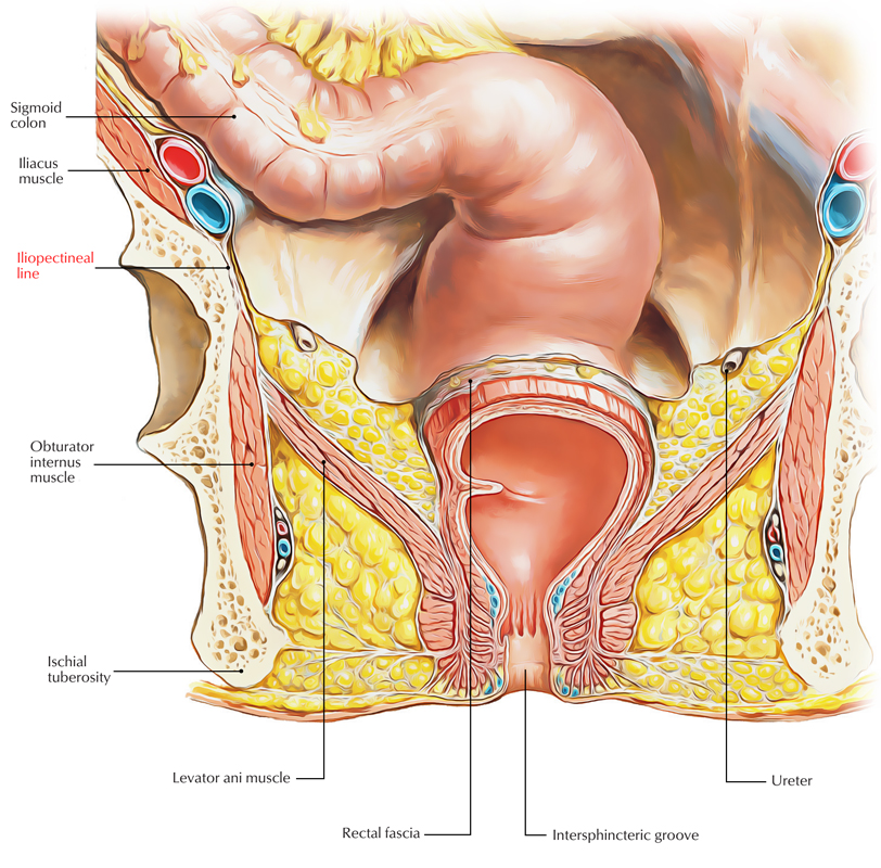 Iliopectineal Line