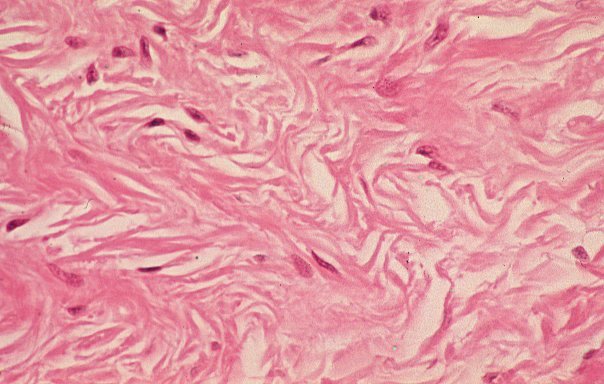 Dense Connective Tissue – Earth's Lab